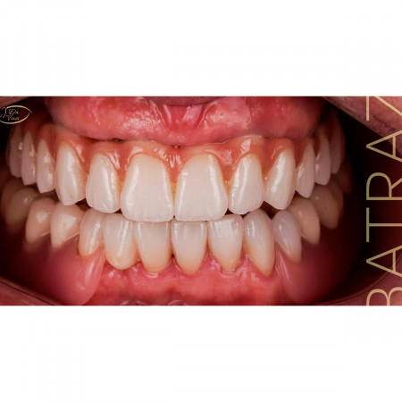Image Slider