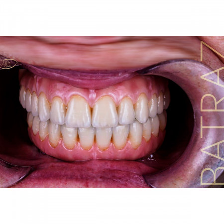 Image Slider